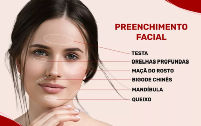 Preenchimento facial